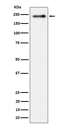 Phospho-LRP6 (S1490) Rabbit mAb