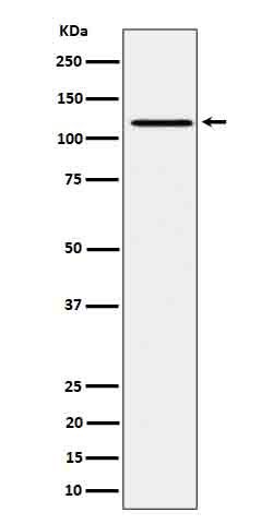 Phospho-JAK1 (Y1034 + Y1035) Rabbit mAb