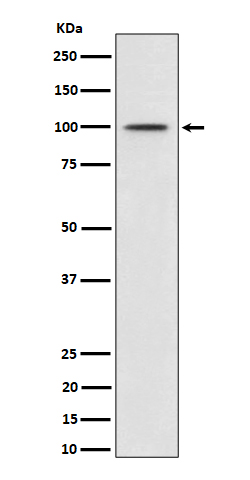 Phospho-MDM2 (S166) Rabbit mAb