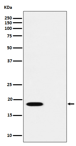 Phospho-PTS (S19) Rabbit mAb