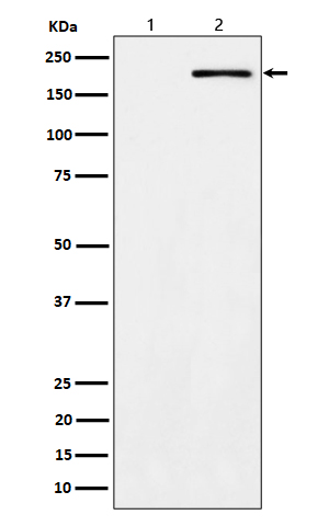 Phospho-ErbB2 (Y1139) Rabbit mAb