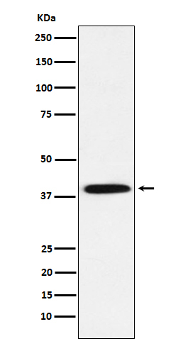 Phospho-IKB alpha (S36) Rabbit mAb