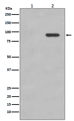 Phospho-beta Catenin (S33/S37) Rabbit mAb