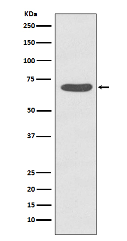 Phospho-PKC zeta (T560) Rabbit mAb