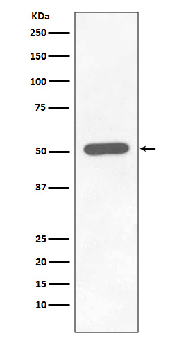 Phospho-Chk1 (S296) Rabbit mAb