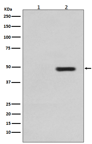 Phospho-Tau (T231) Rabbit mAb