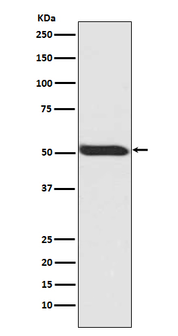 Phospho-p53 (S392) Rabbit mAb