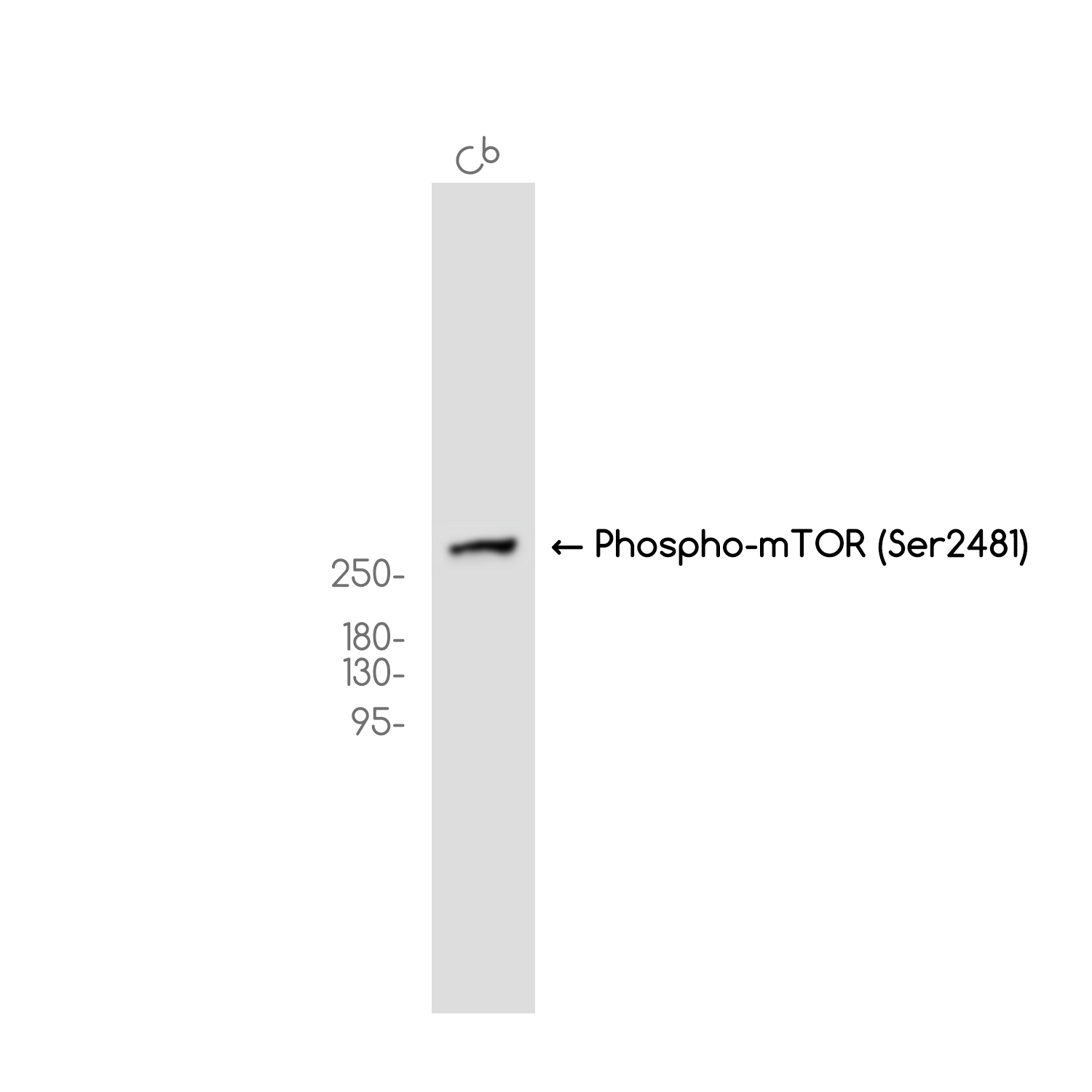 Phospho-mTOR (Ser2481)Rabbit mAb