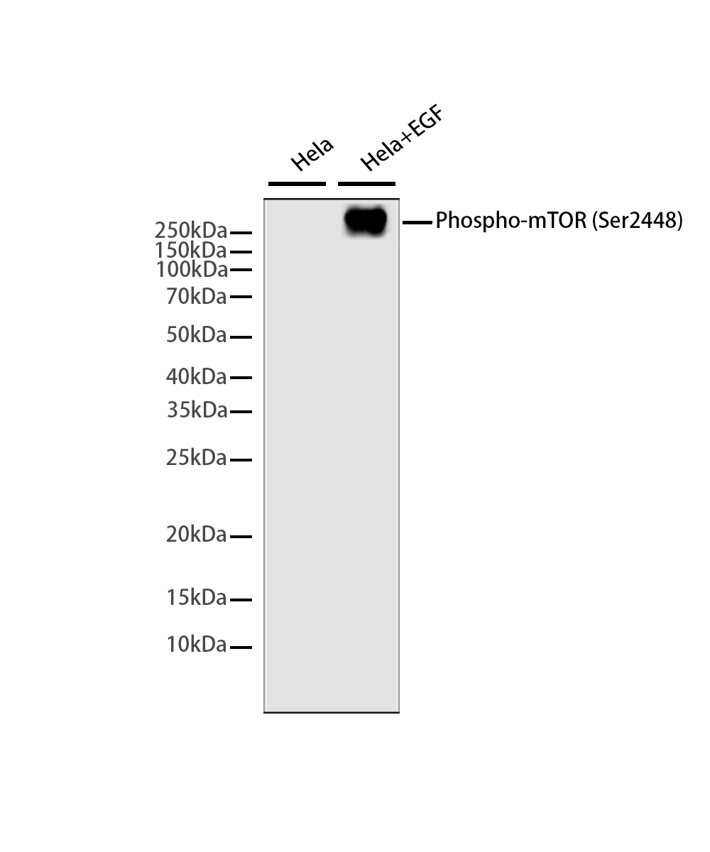 Phospho-mTOR (Ser2448) Rabbit mAb