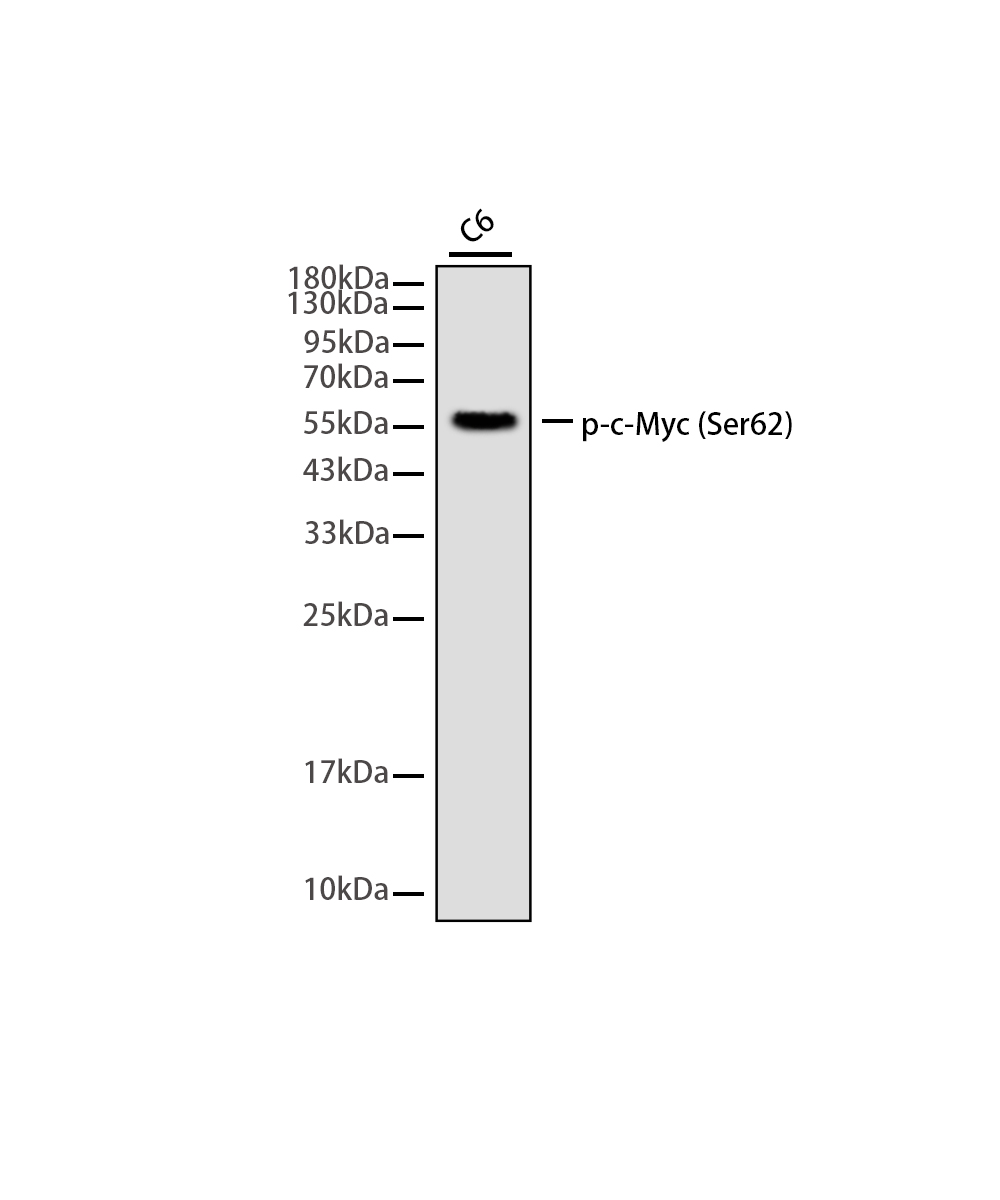 Phospho-c-Myc (Ser62) Rabbit mAb