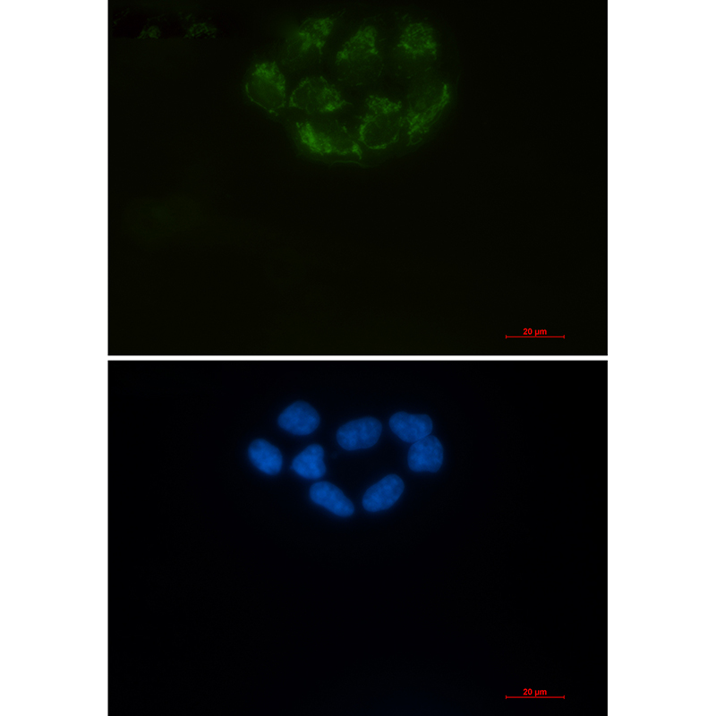 CD147 Rabbit mAb