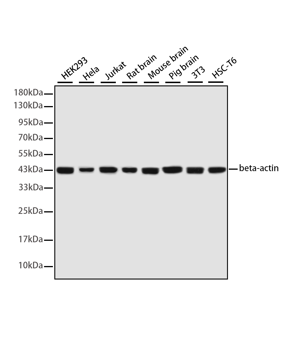 β-actin Rabbit mAb