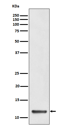 TCTEX1 Rabbit mAb