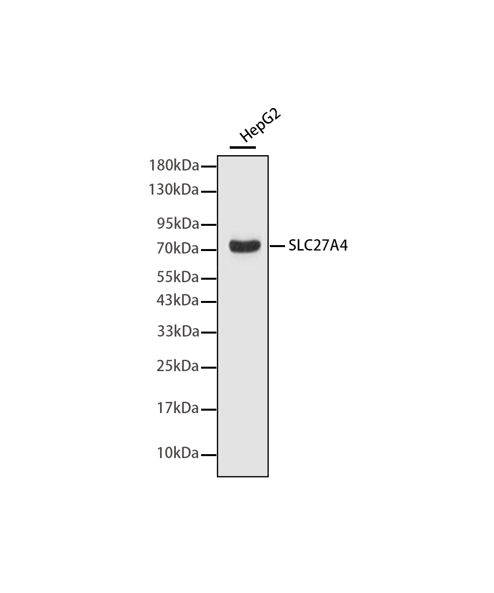 SLC27A4 Rabbit mAb