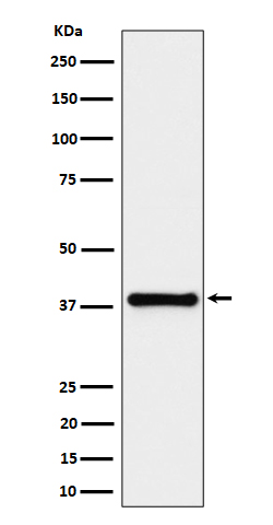 UCHL5IP Rabbit mAb
