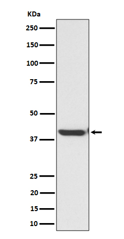 ENDOGL1 / ENGL Rabbit mAb