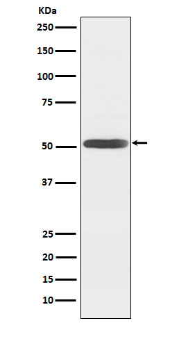 Inhibin beta B Rabbit mAb