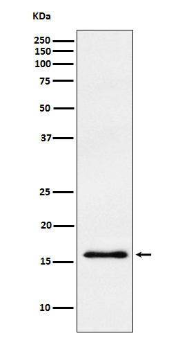 gamma Synuclein  Rabbit mAb