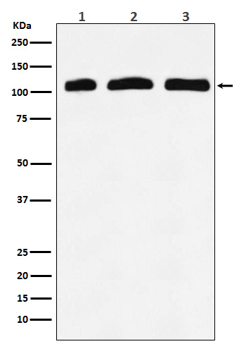 PI 3 Kinase p110 delta  Rabbit mAb