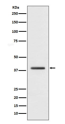macroH2A.1  Rabbit mAb