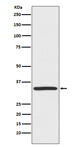 TRADD  Rabbit mAb