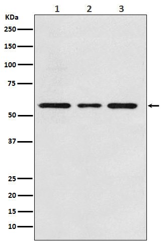 ACVRL1 Rabbit mAb