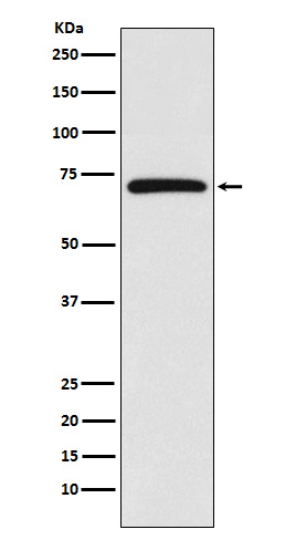 BIRC2  Rabbit mAb