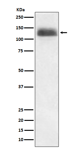 NFAT1 Rabbit mAb