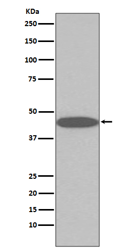 45569Rabbit mAb