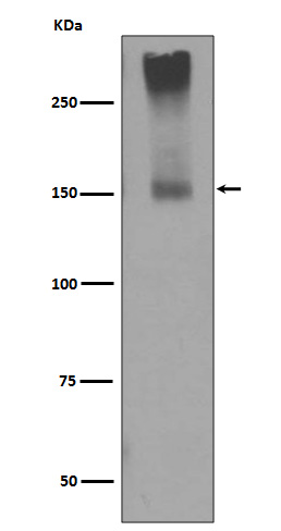 GRM5   Rabbit mAb