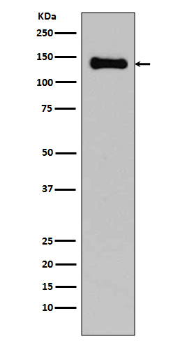 pan Cadherin   Rabbit mAb