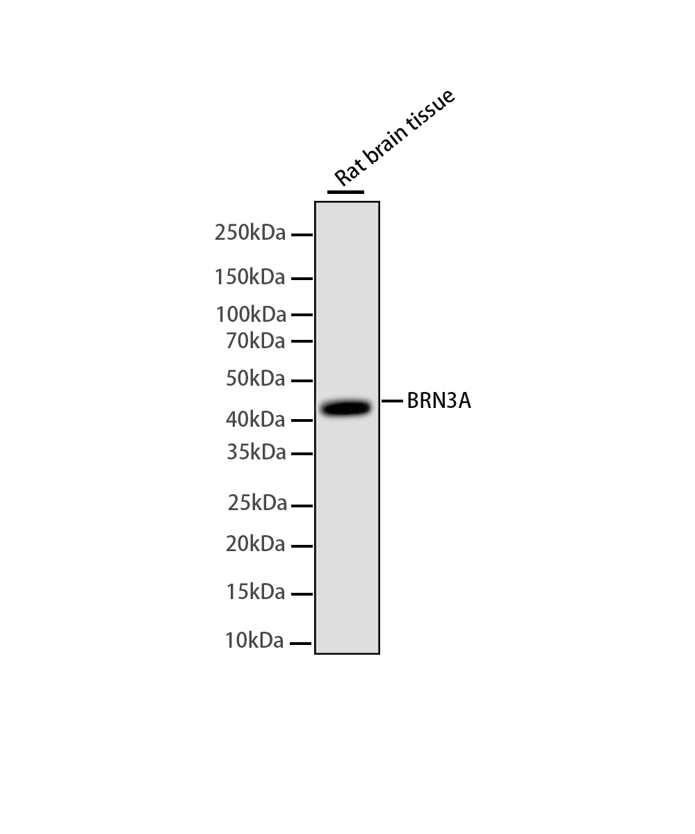 BRN3A Rabbit mAb