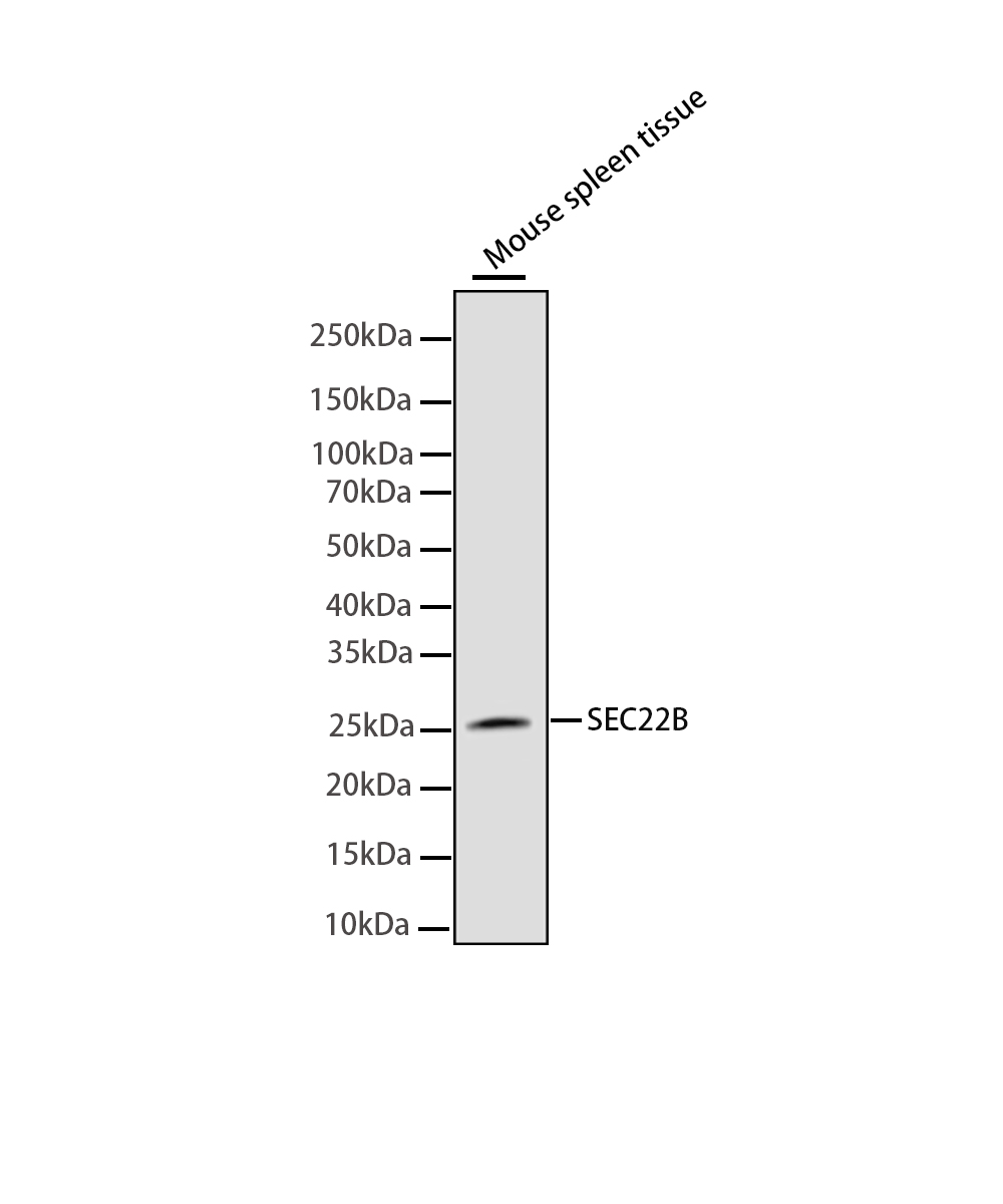 SEC22B Rabbit mAb
