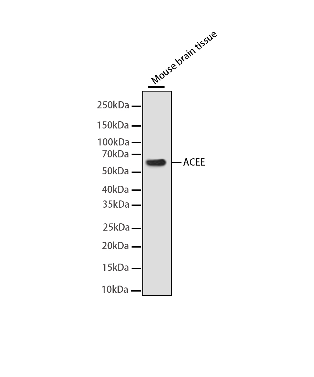 Acetylcholinesterase Rabbit mAb