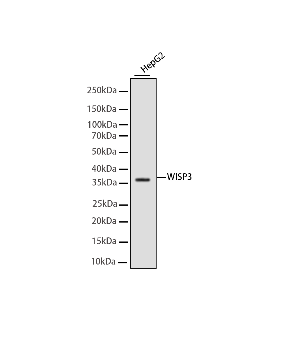 WISP3 Rabbit mAb