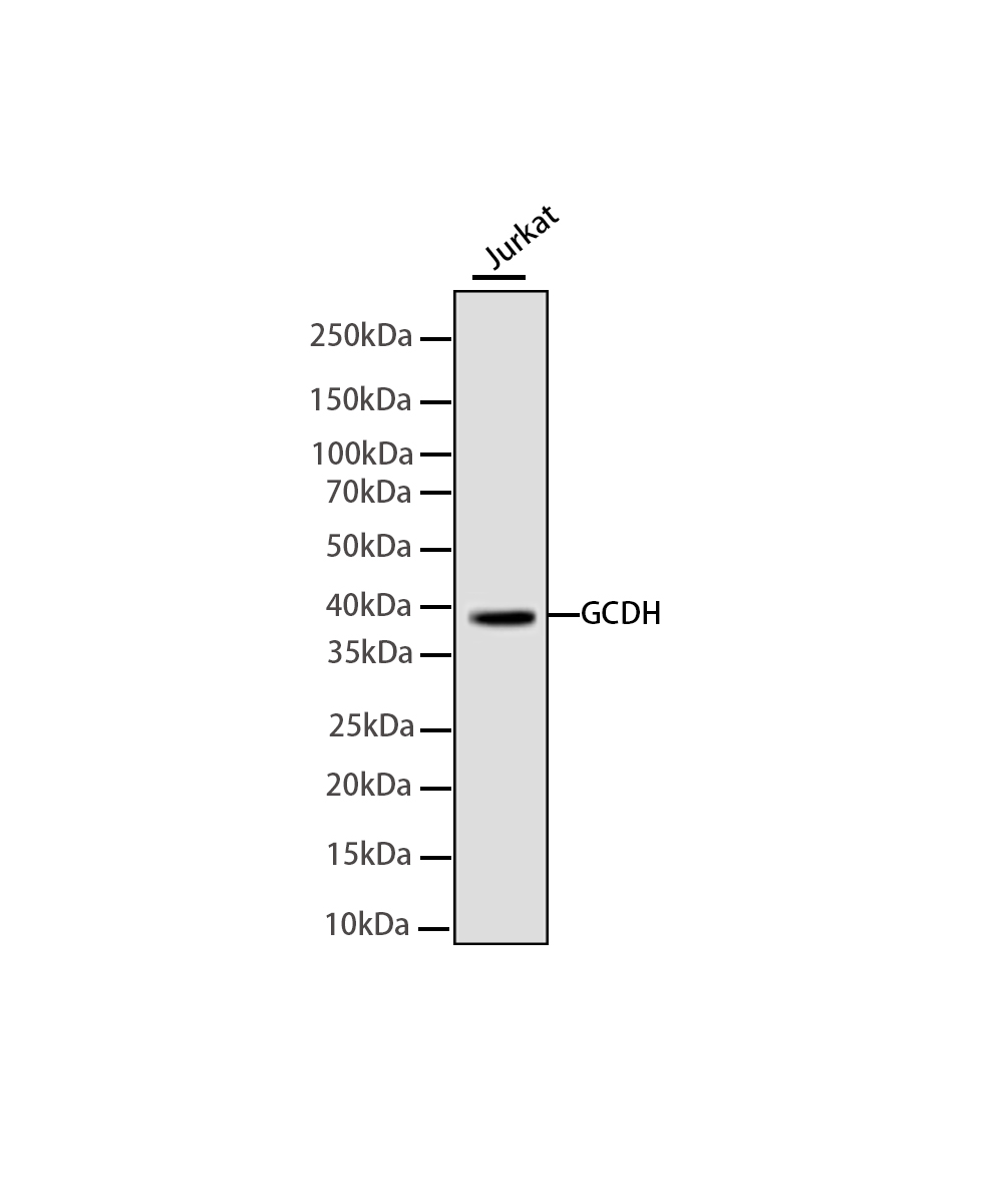 GCDH Rabbit mAb