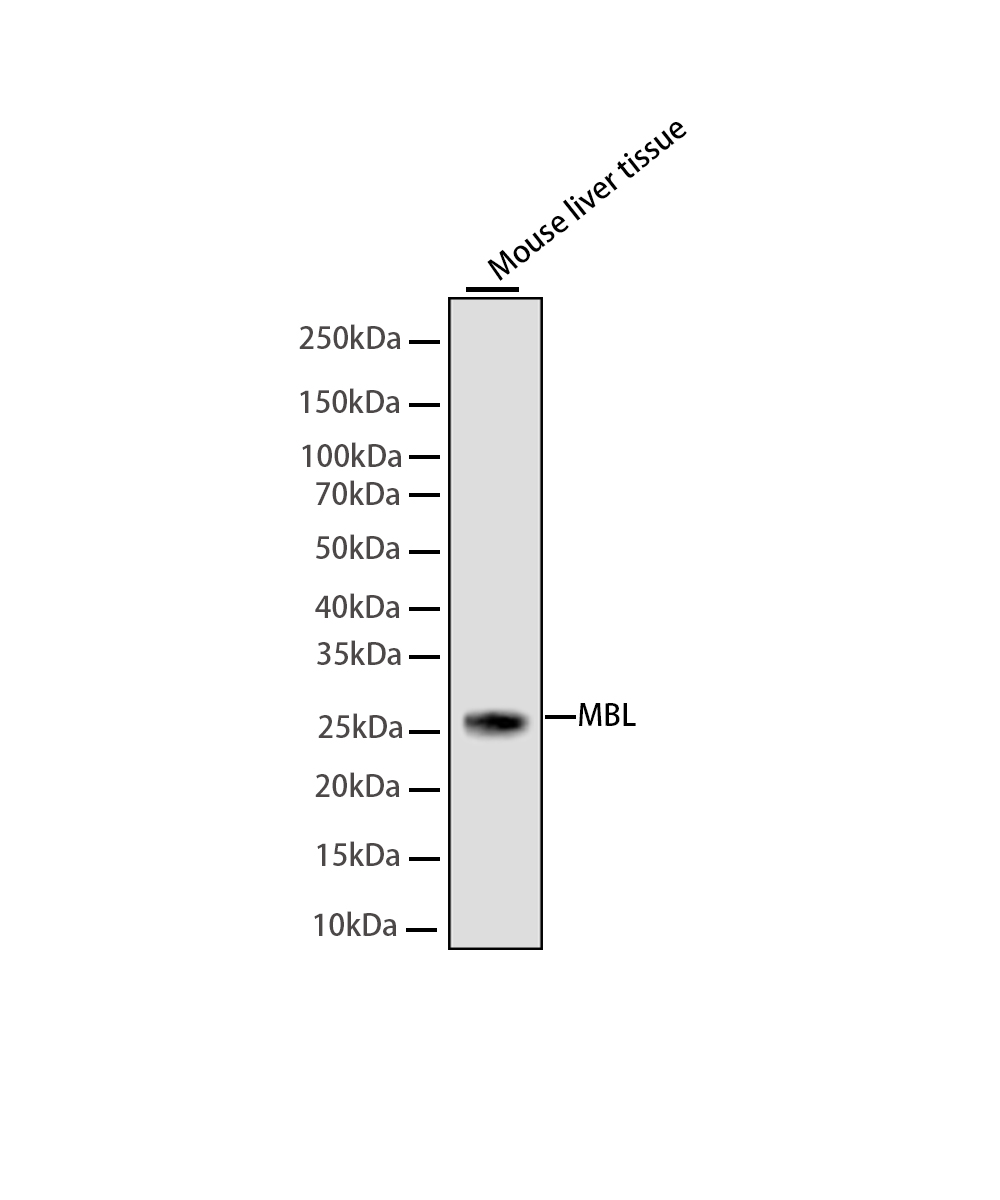 Mannan Binding Lectin Rabbit mAb