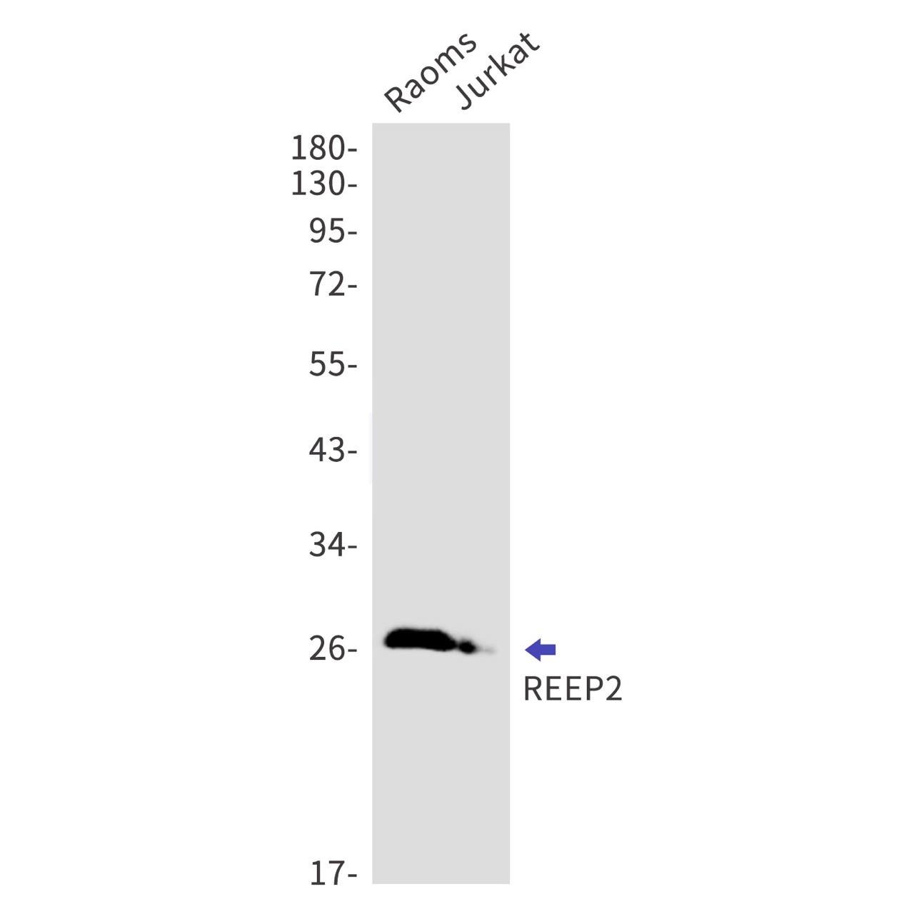 REEP2 Rabbit mAb