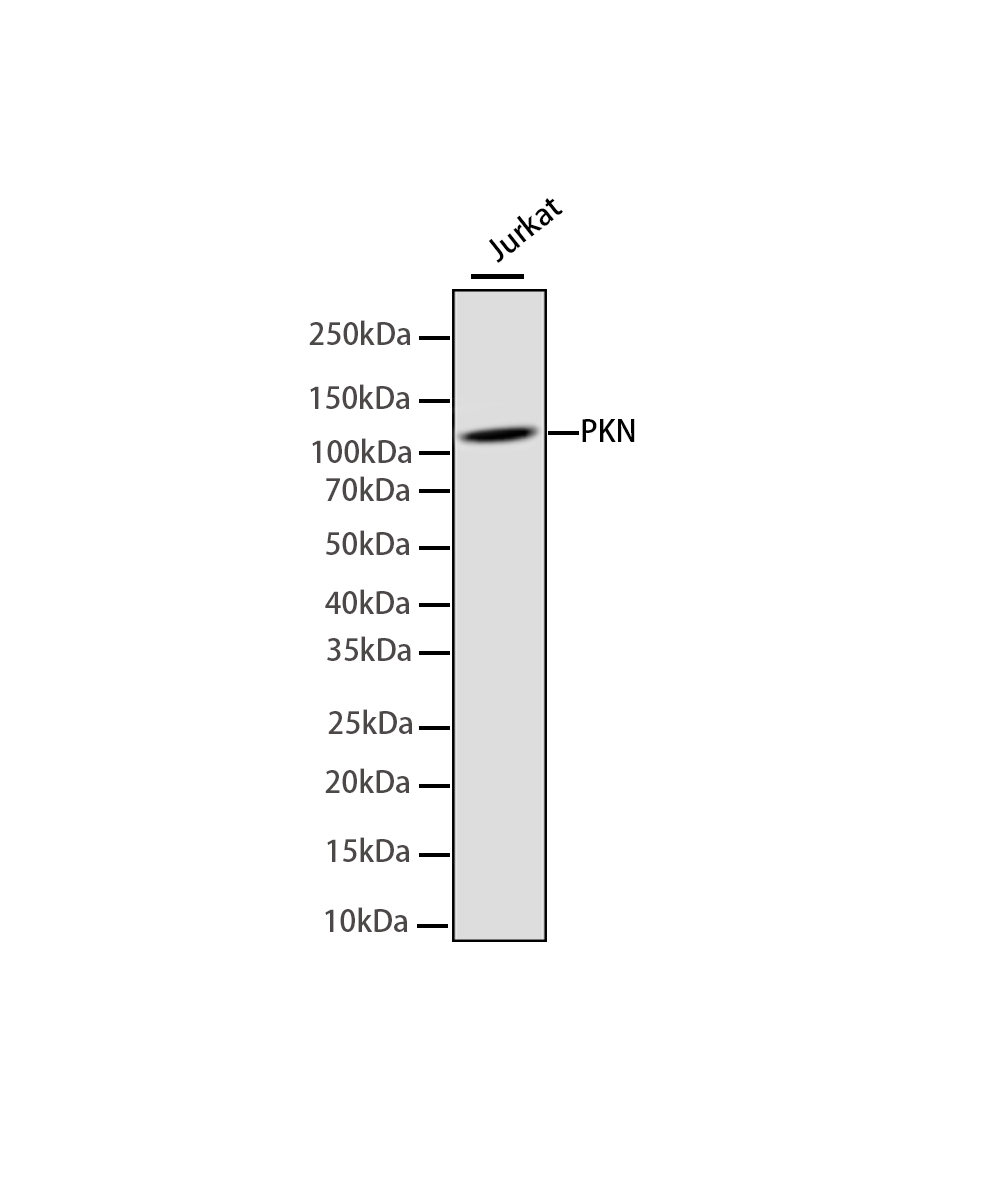 PKN Rabbit mAb