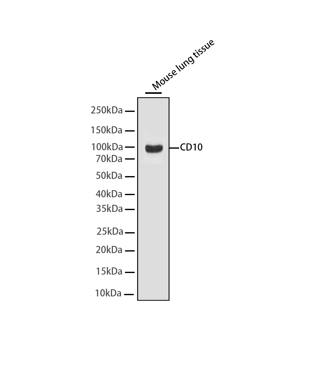 CD10 Rabbit mAb
