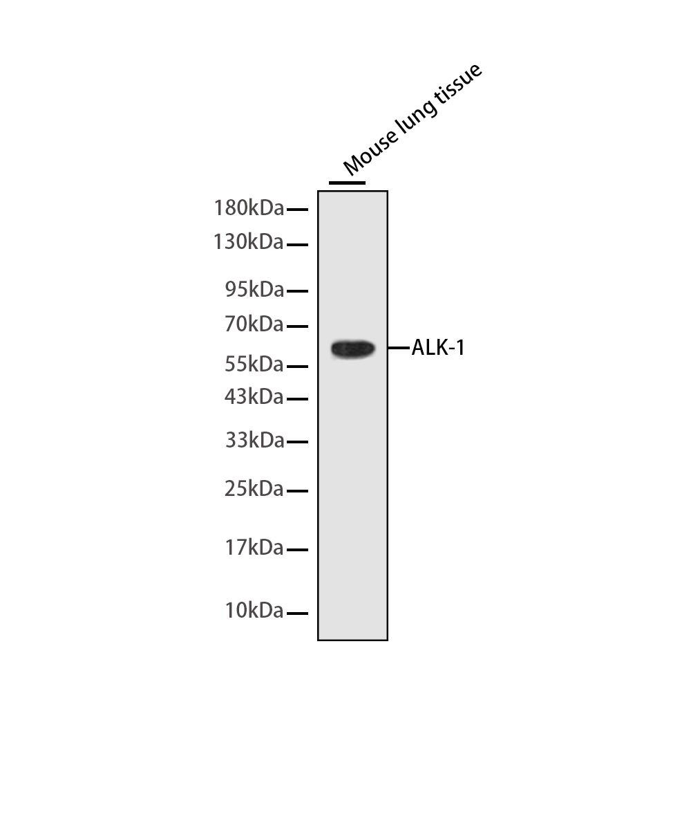 ALK-1 Rabbit mAb