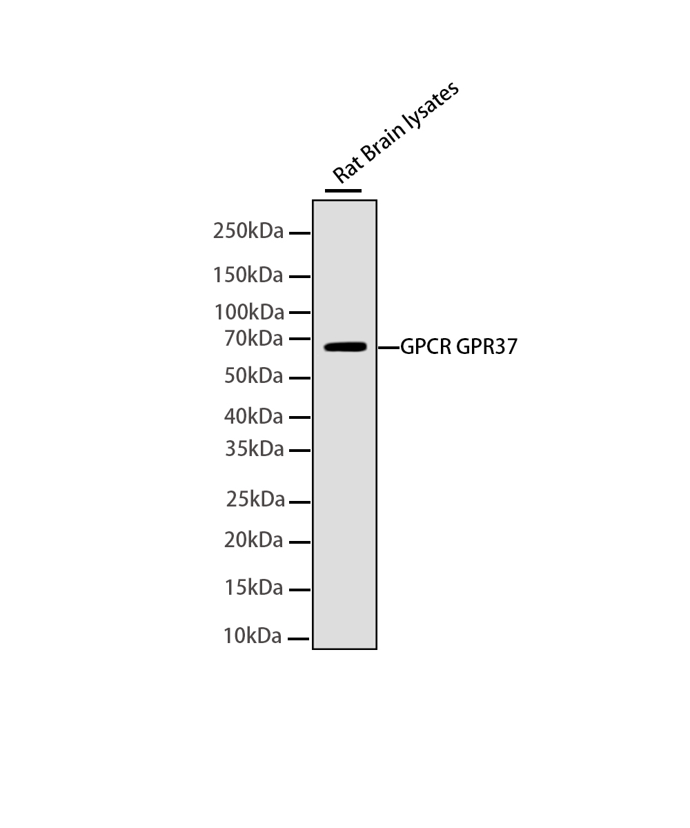 GPCR GPR37 Rabbit mAb