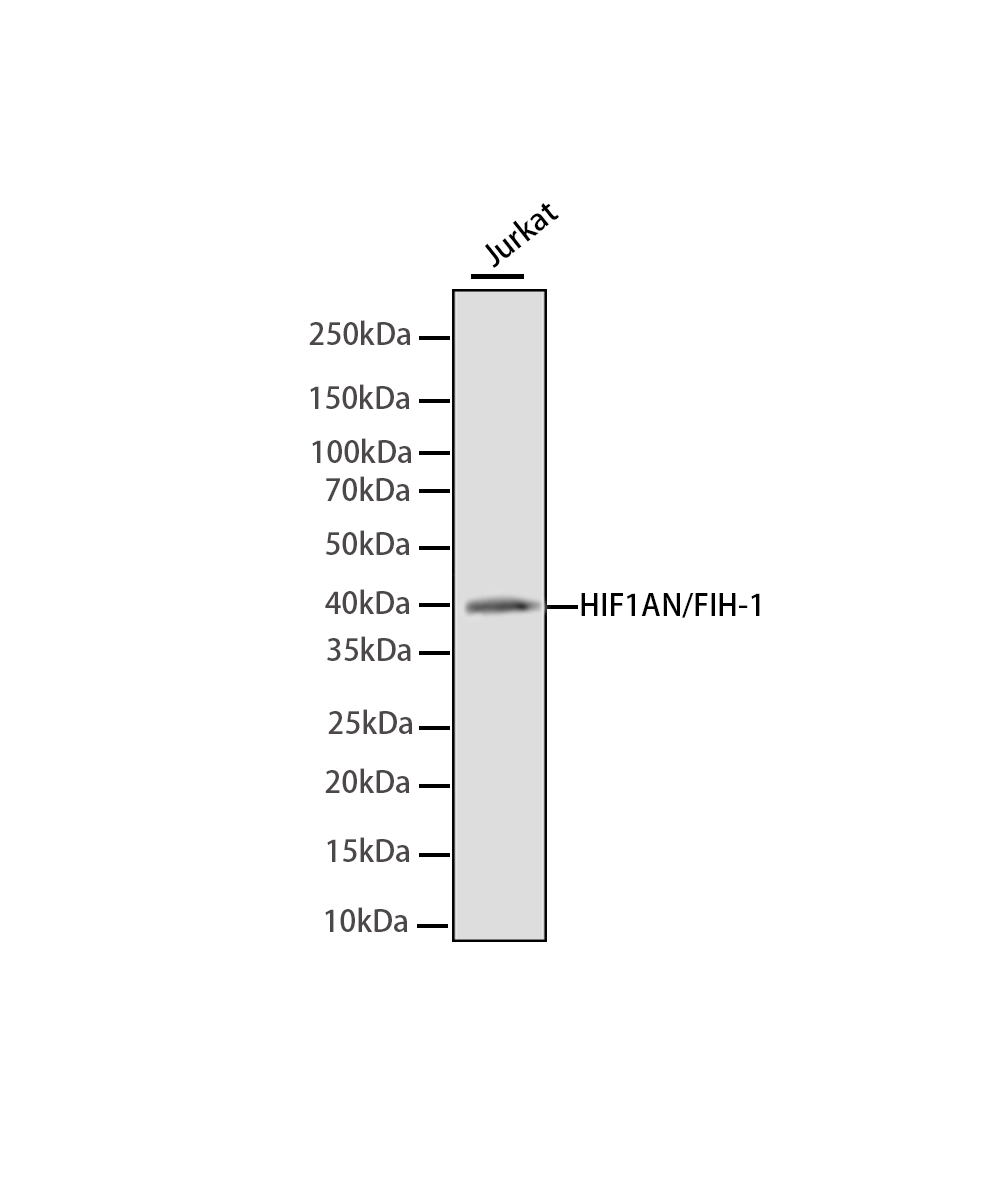 HIF1AN/FIH-1 Rabbit mAb