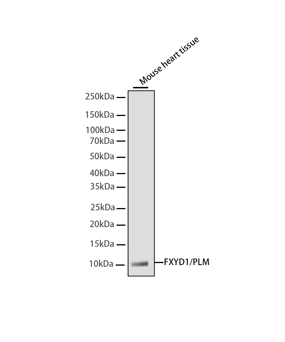 FXYD1/PLM Rabbit mAb