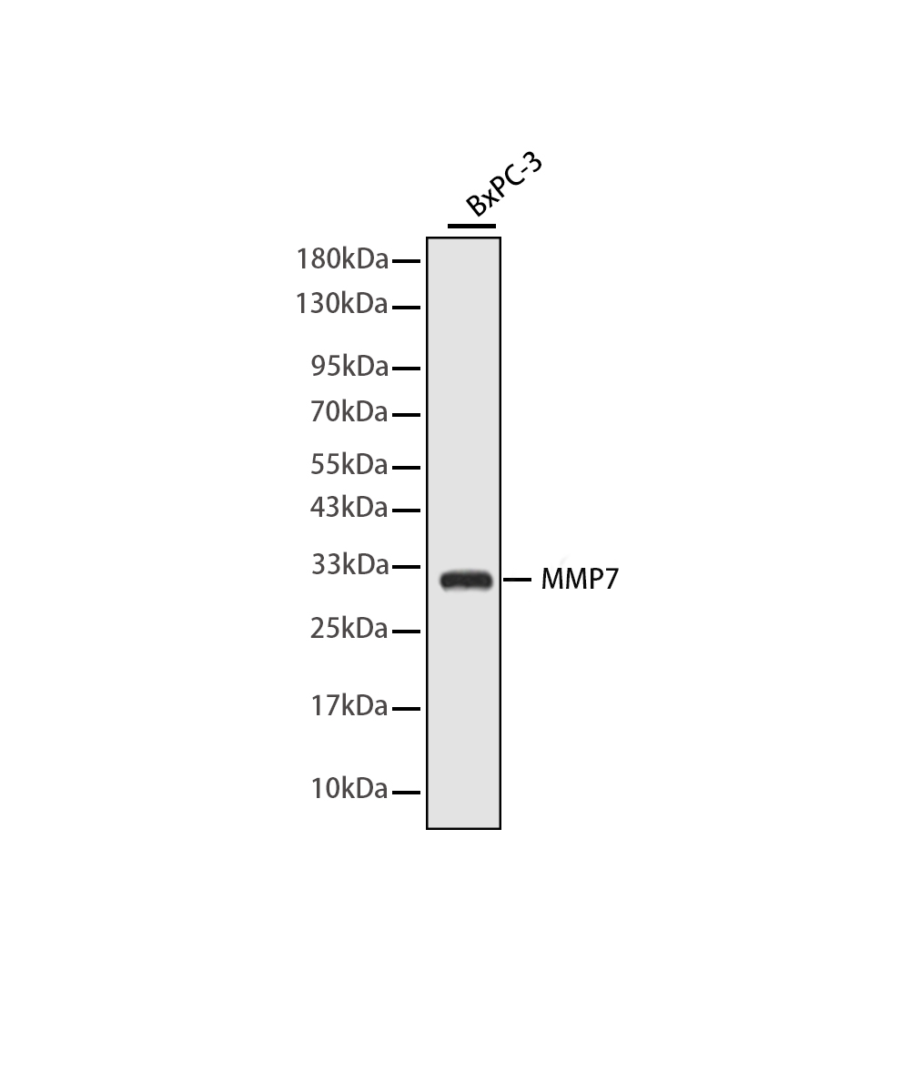 MMP7 Rabbit mAb