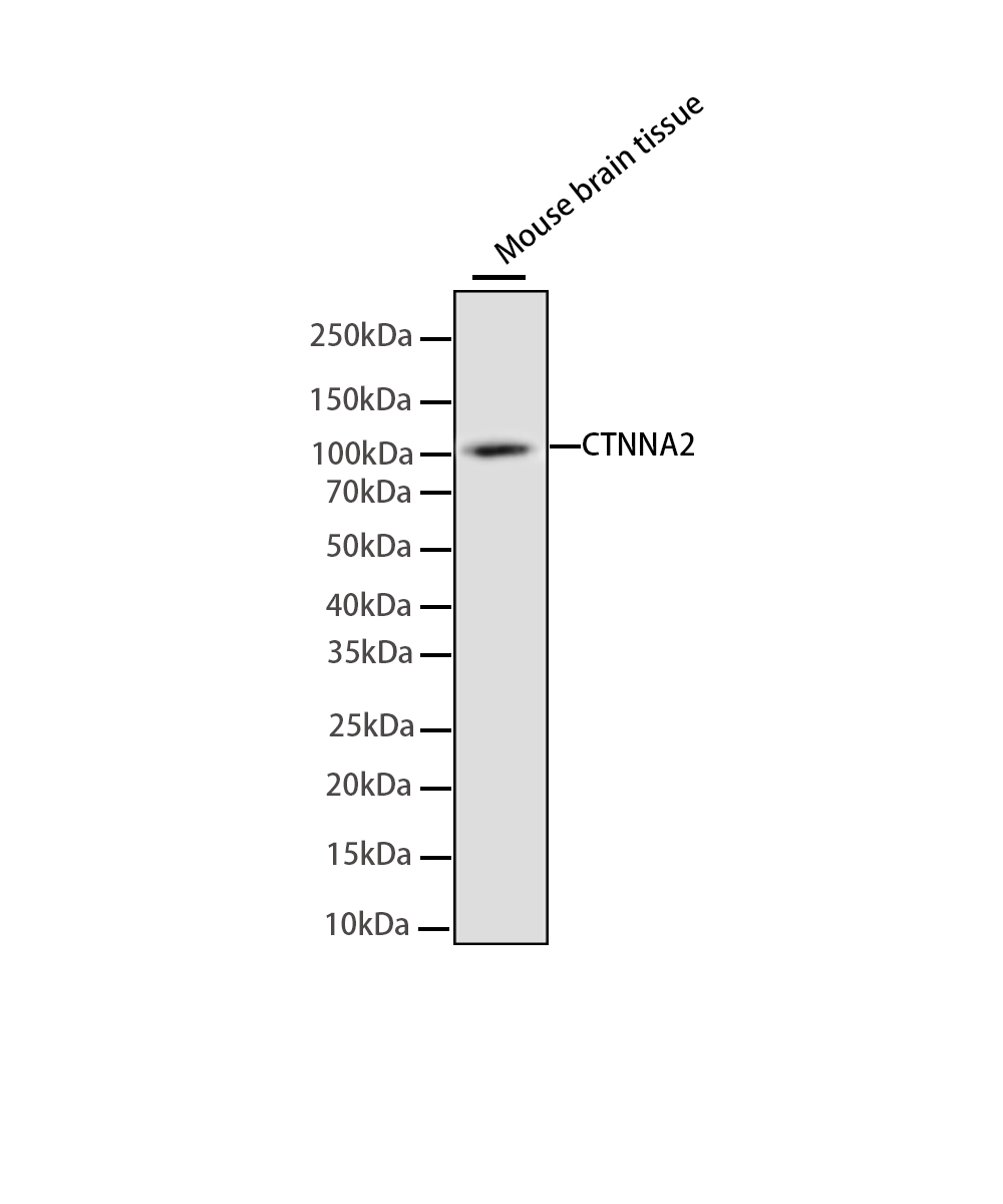CTNNA2 Rabbit mAb