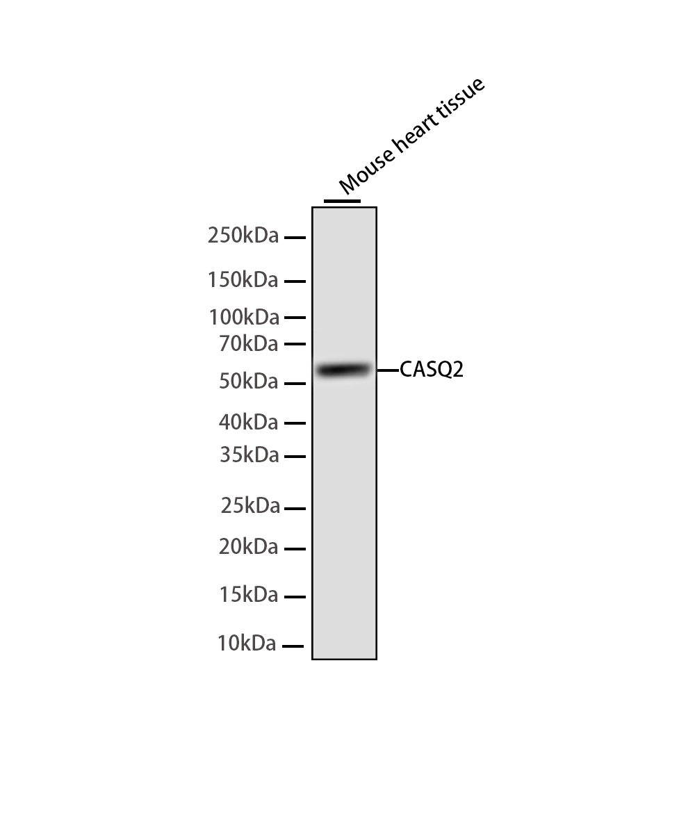 Calsequestrin 2 Rabbit mAb