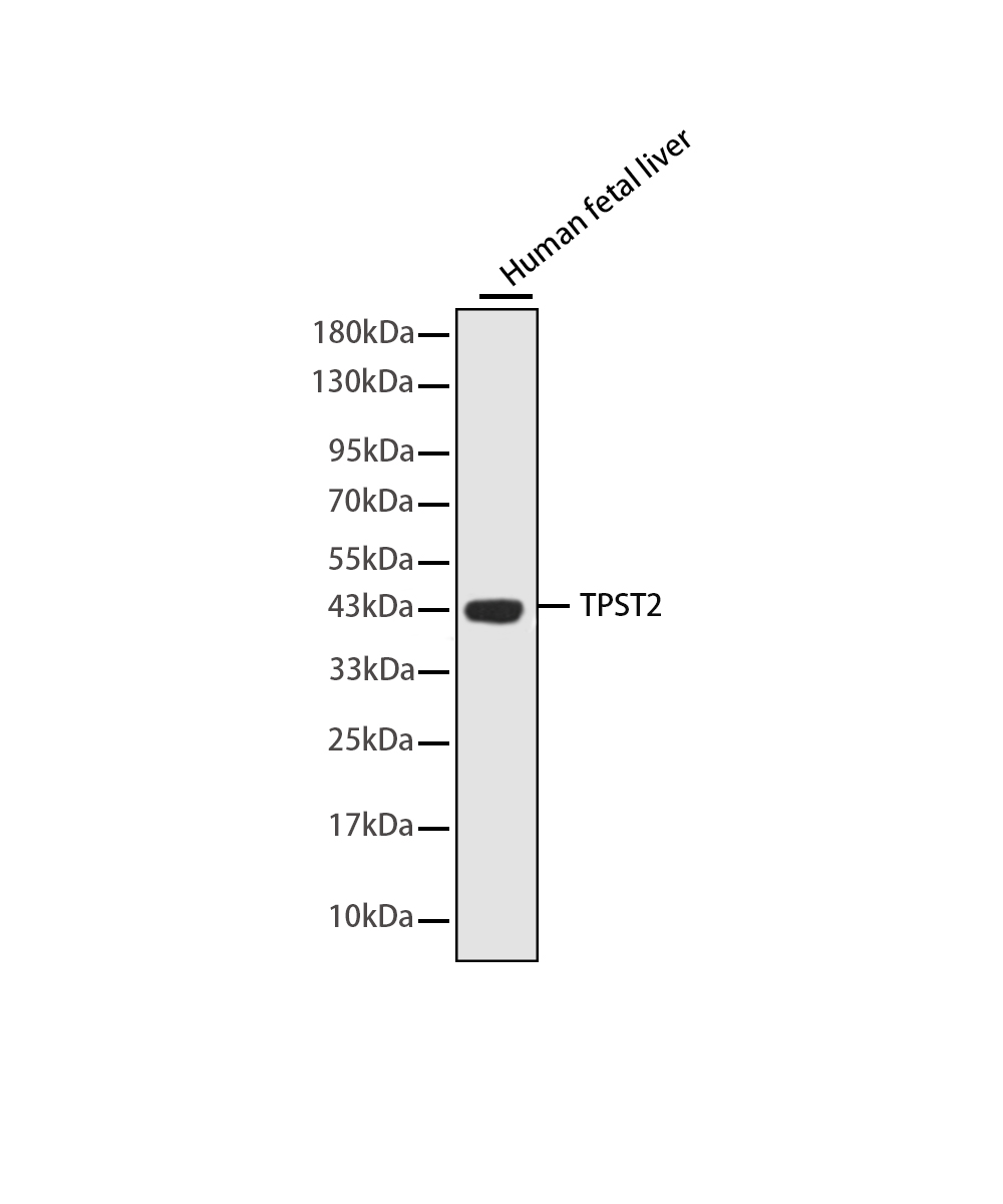 TPST2 Rabbit mAb