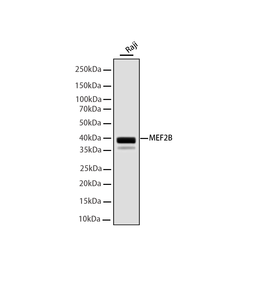MEF2B Rabbit mAb