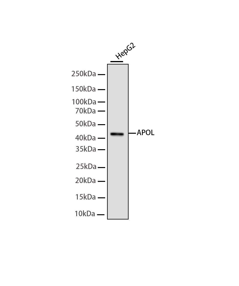 Apolipoprotein L 1 Rabbit mAb